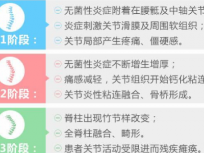 四层局部祛炎—局部祛炎治疗强直