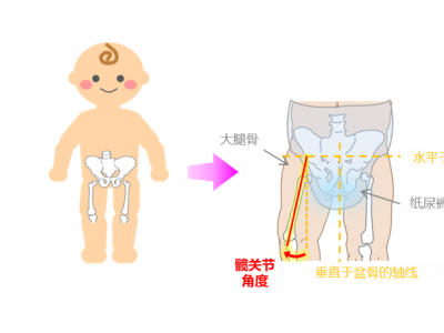穿着纸尿裤对幼儿步行影响的因素解析